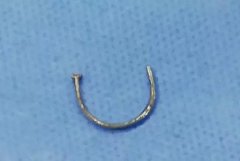 3cm��U���θֶ���Խ���򣬻��������ۿ�ר�����ְγ������ж���